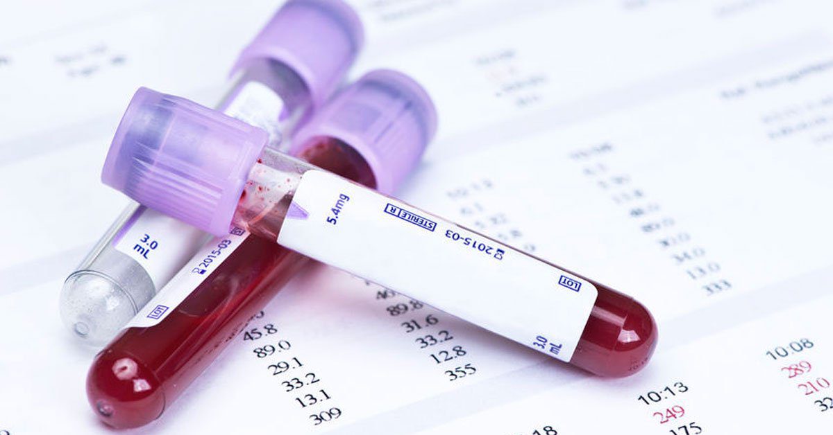 What blood tests should I have?